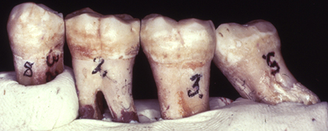 Krapina mandible M molars